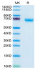 Recombinant Human NKp46/NCR1/CD335 Protein (RPCB0464)