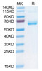 Recombinant Human KLRB1/CD161 Protein (RPCB0478)