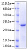Recombinant Human NKG2-D/KLRK1/CD314 Protein (RPCB0485)