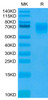 Recombinant Human PVR/CD155 Protein (RPCB0489)