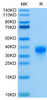 Recombinant Human Fc gamma RIIA/FCGR2A/CD32a (H167R) Protein (RPCB0495)