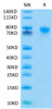 Recombinant Human TNFRSF1B/TNF-R2/CD120b Protein (RPCB0500)