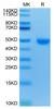 Recombinant Human Nectin-2/PVRL2/CD112 Protein (RPCB0501)