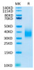 Biotinylated Recombinant Human TREM2 Protein (RPCB0503)