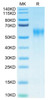 Biotinylated Recombinant Human IL-15RA/CD215 Protein (RPCB0505)