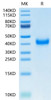 Recombinant Human KLRB1/CD161 Protein (RPCB0510)