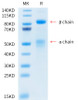 Recombinant Human HGF receptor/c-MET/MET Protein (RPCB0511)