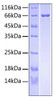 Recombinant Human R-spondin-3/RSPO3 Protein (RPCB0519)