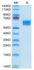 Recombinant Human IL-1R1/CD121a Protein (RPCB0523)