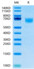 Recombinant Human FGFR-3 alpha (IIIc)/CD333 Protein (RPCB0524)