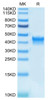Biotinylated Recombinant Human IL-2 R alpha/CD25 Protein (RPCB0529)