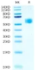 Recombinant Human IL-1R1/CD121a Protein (RPCB0530)