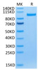 Recombinant Human sTfR/CD71 Protein (RPCB0538)