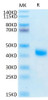 Recombinant Human IL-2 R beta/CD122 Protein (RPCB0539)