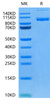 Recombinant Human PSMA/FOLH1 Protein (RPCB0540)