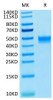 Recombinant Human FGFR-3 beta (IIIb)/CD333 Protein (RPCB0548)