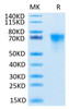 Recombinant Human FGFR-3 alpha (IIIb)/CD333 Protein (RPCB0549)
