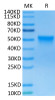 Recombinant Human FGFR-3 beta (IIIc)/CD333 Protein (RPCB0550)