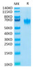 Biotinylated Recombinant Human CEACAM6/CD66c Protein (RPCB0555)