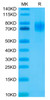 Recombinant Human ERBB1/HER1/EGFR (25-378) Protein (RPCB0568)