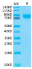 Biotinylated Recombinant Human B7-H3 (4Ig)/B7-H3b/CD276 Protein (RPCB0572)