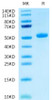 Recombinant Human CEACAM3/CD66d Protein (RPCB0574)