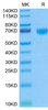 Biotinylated Recombinant Human PD-1/PDCD1/CD279 Protein (RPCB0577)