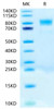 Biotinylated Recombinant Human c-Kit/CD117 Protein (RPCB0579)