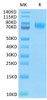 Recombinant Human B7-H3 (4Ig)/B7-H3b/CD276 Protein (RPCB0581)