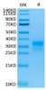 Recombinant Human ERBB2/HER2/CD340 (489-630) Protein (RPCB0582)