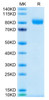 Recombinant Human CSF2RA/GM-CSF R alpha/CD116 Protein (RPCB0584)