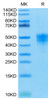 Recombinant Human TROP-2/TACSTD2 Protein (RPCB0586)