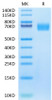 Biotinylated Recombinant Human ERBB1/HER1/EGFR (25-378) Protein (RPCB0590)