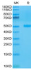 Recombinant Human CTLA-4/CD152 Protein (RPCB0591)
