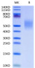 Recombinant Human CD44 Protein (RPCB0598)