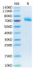 Recombinant Human IL-12 R beta 1/CD212 Protein (RPCB0599)
