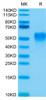 Biotinylated Recombinant Human Fc-gamma RIII alpha/FCGR3A/CD16a (F176V) Protein (RPCB0612)