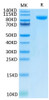 Recombinant Human B7-H3 (4Ig)/B7-H3b/CD276 Protein (RPCB0615)