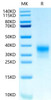 Biotinylated Recombinant Human ERBB2/HER2/CD340 (489-630) Protein (RPCB0617)
