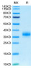 Biotinylated Recombinant Human Fc gamma RIIA/FCGR2A/CD32a (H167R) Protein (RPCB0626)