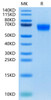 Recombinant Human CSF2RA/GM-CSF R alpha/CD116 Protein (RPCB0629)