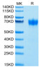 Biotinylated Recombinant Human CSF2RA/GM-CSF R alpha/CD116 Protein (RPCB0632)