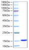 Recombinant Human FABP1/L-FABP Protein (RPCB0634)