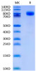 Recombinant Human CD44 Protein (RPCB0636)