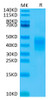 Biotinylated Recombinant Human B29/CD79B Protein (RPCB0640)