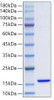 Recombinant Human FABP3/H-FABP Protein (RPCB0642)