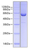 Recombinant Human Serpin H1/HSP47 Protein (RPCB0647)