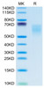 Recombinant Human B7-2/CD86 Protein (RPCB0650)