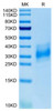Recombinant Human Basigin EMMPRIN/CD147 Protein (RPCB0656)