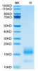 Recombinant Human TNFRSF17/BCMA/CD269 Protein (RPCB0657)
